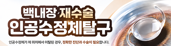 백내장재수술