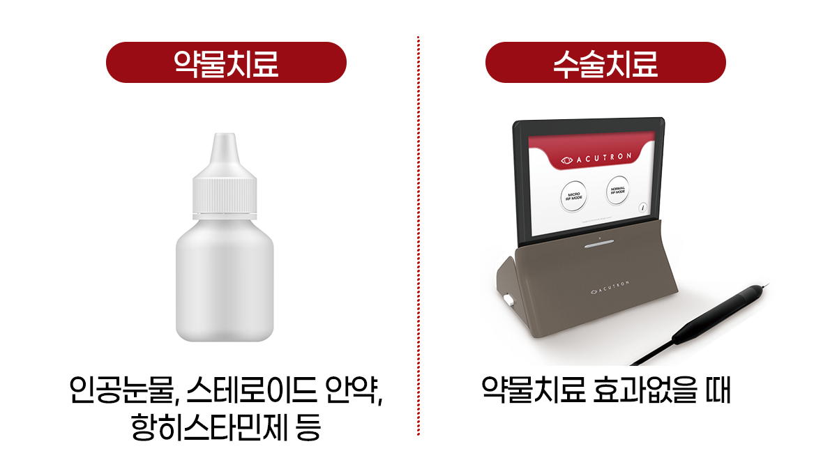 고주파 결막이완증 수술